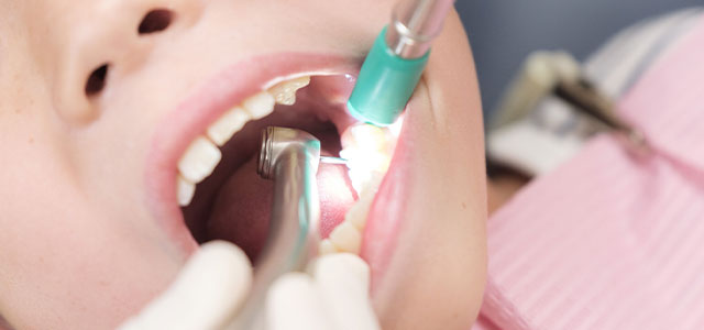 乳歯が虫歯になることによる悪影響